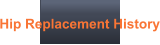Hip Replacement History